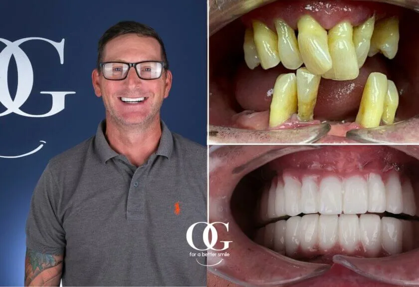 Behandlungsergebnis der OG Dental Clinic