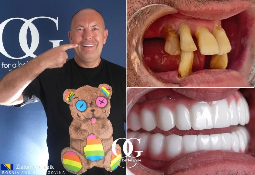 Behandlungsergebnis der OG Dental Clinic